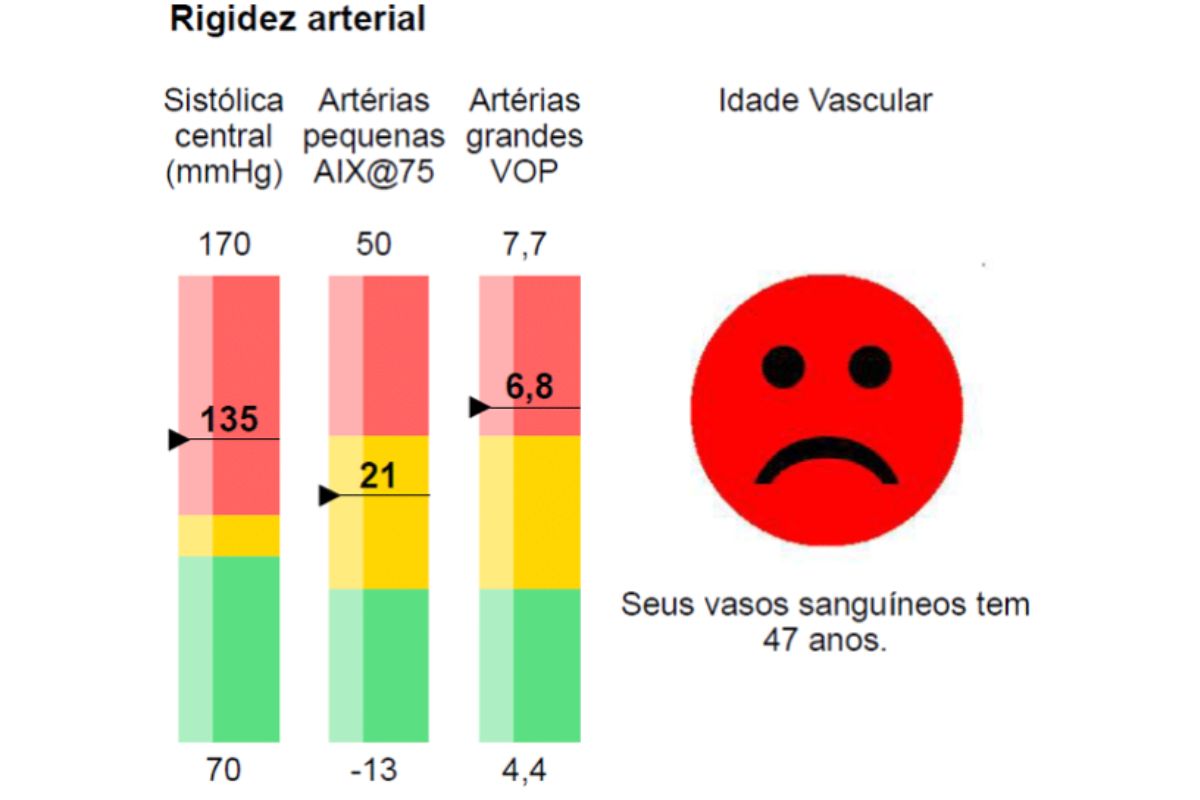 Exame de velocidade de onda de pulso